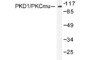 Image no. 1 for anti-Protein Kinase D1 (PRKD1) antibody (ABIN272067) (PKC mu anticorps)