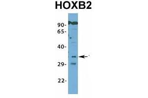 Host:  Rabbit  Target Name:  HOXB2  Sample Type:  721_B  Antibody Dilution:  1.