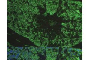 anti-Defensin, beta 121 (DEFB121) antibody