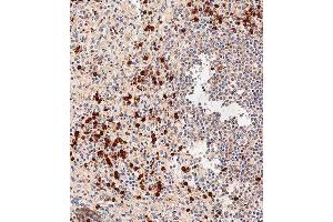 Immunohistochemical analysis of paraffin-embedded human spleen tissue using (ABIN655750 and ABIN2845194) performed on the Leica® BOND RXm.