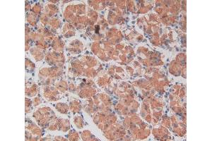 IHC-P analysis of stomach tissue, with DAB staining. (TEP1 anticorps  (AA 2368-2627))