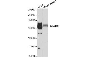 Western blot analysis of extracts of various cell lines, using NFATC3 antibody (ABIN2564121) at 1:500 dilution. (NFATC3 anticorps)