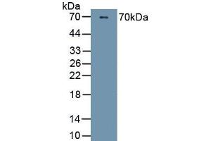 Detection of Recombinant PI16, Human using Polyclonal Antibody to Peptidase Inhibitor 16 (PI16) (PI16 anticorps  (AA 28-247))