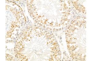 ABIN6266092 and ABIN6273027 at 1/100 staining Rat testis tissue by IHC-P.