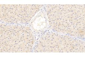 Detection of MMP2 in Human Liver Tissue using Monoclonal Antibody to Matrix Metalloproteinase 2 (MMP2)