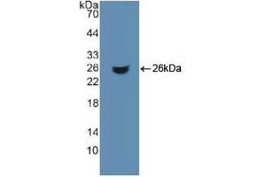 Western blot analysis of recombinant Human ACO1. (Aconitase 1 anticorps  (AA 26-243))