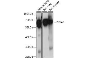 Western blot analysis of extracts of various cell lines, using PLVAP antibody (ABIN7269386) at 1:1000 dilution. (PLVAP anticorps  (AA 63-442))