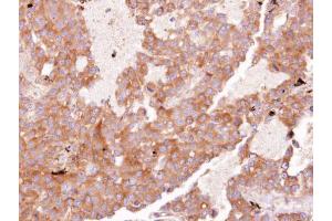 IHC-P Image Immunohistochemical analysis of paraffin-embedded HUH7 xenograft, using EIF3 zeta, antibody at 1:100 dilution.