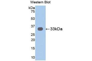 Detection of Recombinant IL31RA, Human using Polyclonal Antibody to Interleukin 31 Receptor A (IL31RA) (IL31RA anticorps  (AA 205-456))