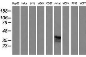 Western Blotting (WB) image for anti-T-cell surface glycoprotein CD1c (CD1C) antibody (ABIN2670659) (CD1c anticorps)