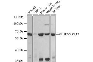 Western blot analysis of extracts of various cell lines, using GLUT2/GLUT2/SLC2 antibody (ABIN6134110, ABIN6147959, ABIN6147960 and ABIN6225170) at 1:1000 dilution.