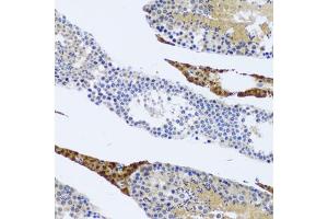 Immunohistochemistry of paraffin-embedded rat testis using FMOD antibody (ABIN2562633) at dilution of 1:100 (20x lens). (Fibromodulin anticorps)