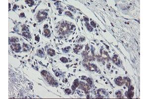 Immunohistochemical staining of paraffin-embedded Human breast tissue using anti-APP mouse monoclonal antibody. (APP anticorps)