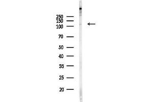Western blot analysis of lysates from HepG2 cells(heat-shock,45 min treatment), using USP11 Antibody at 1/1000 dilution.