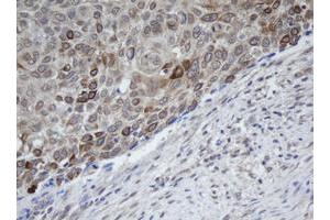 Image no. 1 for anti-Melanoma Antigen Family B, 1 (MAGEB1) antibody (ABIN1499265)