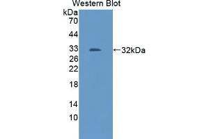 Detection of Recombinant TRAF2, Mouse using Polyclonal Antibody to TNF Receptor Associated Factor 2 (TRAF2) (TRAF2 anticorps  (AA 238-491))