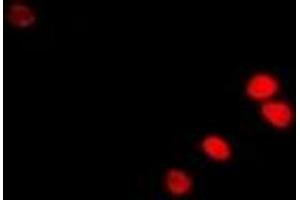 Immunofluorescent analysis of RAG-2 staining in U2OS cells. (RAG2 anticorps)