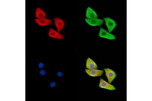 ABIN6265053 and ABIN6279817 staining Hela cells by IF/ICC. (SH3BGRL anticorps  (Internal Region))