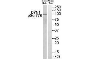 Western blot analysis of extracts from Mouse brain cells, using DYN1 (Phospho-Ser778) antibody.