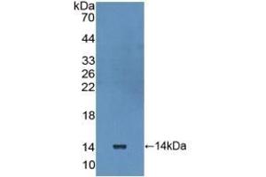 Detection of Recombinant IL10Ra, Human using Polyclonal Antibody to Interleukin 10 Receptor Alpha (IL10Ra) (IL-10RA anticorps  (AA 132-235))