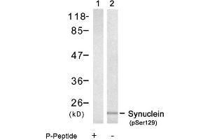 Image no. 1 for anti-Synuclein, alpha (SNCA) (pSer129) antibody (ABIN319236)