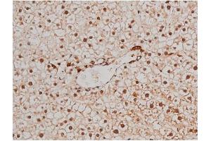 ABIN6267433 at 1/200 staining Rat liver tissue sections by IHC-P. (Filamin A anticorps  (pSer2152))