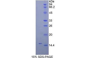 SDS-PAGE analysis of Mouse Inhibin beta C Protein. (INHBC Protéine)