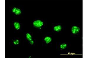 Immunofluorescence of purified MaxPab antibody to NOLC1 on HeLa cell. (NOLC1 anticorps  (AA 1-700))