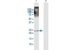 Western Blot analysis of TRIML1 expression in transfected 293T cell line by TRIML1 MaxPab polyclonal antibody. (TRIML1 anticorps  (AA 1-192))