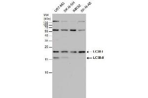 WB Image LC3B antibody detects LC3B protein by western blot analysis.