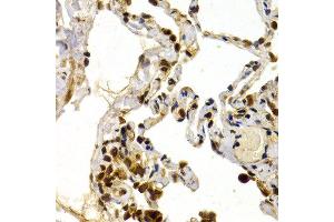 Immunohistochemistry of paraffin-embedded human normal lung using TFDP1 antibody at dilution of 1:200 (400x lens). (DP1 anticorps)