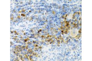 Immunohistochemistry of paraffin-embedded Mouse spleen using SULT2A1 Polyclonal Antibody at dilution of 1:200 (40x lens).