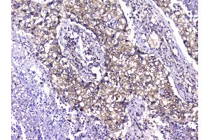 IHC analysis of TCP1 alpha using anti-TCP1 alpha antibody . (TCP1 alpha/CCTA anticorps  (C-Term))