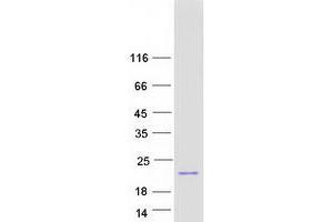 Validation with Western Blot