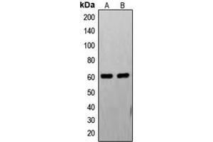 Western blot analysis of FAST Kinase expression in PC12 (A), HL60 (B) whole cell lysates. (FASTK anticorps  (Center))