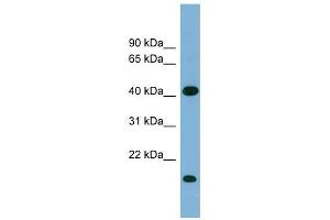 BXDC2 antibody used at 1 ug/ml to detect target protein. (BRIX1 anticorps  (Middle Region))