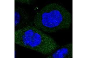 Immunofluorescent staining of human cell line A-431 with WIBG polyclonal antibody  at 1-4 ug/mL dilution shows positivity in cytoplasm.