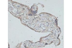 Immunohistochemistry of paraffin-embedded Human placenta using GMPR Polyclonal Antibody at dilution of 1:100 (40x lens). (GMPR anticorps)