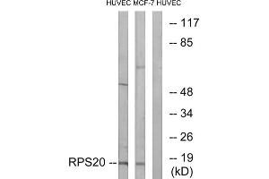 Western blot analysis of extracts from HUVEC cells and MCF-7 cells, using RPS20 antibody. (RPS20 anticorps  (Internal Region))