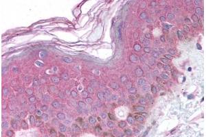 Human Skin (formalin-fixed, paraffin-embedded) stained with BARD1 antibody ABIN214634 at 10 ug/ml followed by biotinylated goat anti-rabbit IgG secondary antibody ABIN481713, alkaline phosphatase-streptavidin and chromogen. (BARD1 anticorps  (AA 108-124))