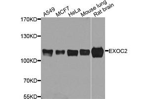 Western blot analysis of extracts of various cell lines, using EXOC2 antibody. (EXOC2 anticorps)