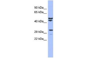 WB Suggested Anti-MRPS15 Antibody Titration:  0. (MRPS15 anticorps  (N-Term))