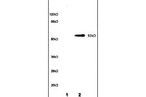 Lane 1: rat brain lysates Lane 2: rat kidney lysates probed with Anti CYP11A1 P450SCC Polyclonal Antibody, unconjugated (ABIN701530) at 1:200 in 4 °C Followed by conjugation to secondary antibody (ABIN727474-HRP) at 1:3000 90min in 37 °C Predicted band 53kD. (CYP11A1 anticorps  (AA 321-420))