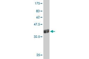 Western Blot detection against Immunogen (37.
