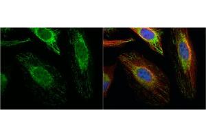 ICC/IF Image ACAT1 antibody [N1N3] detects ACAT1 protein at mitochondria by immunofluorescent analysis.