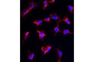 Image no. 3 for anti-Nanos Homolog 1 (NANOS1) (C-Term) antibody (ABIN356876) (Nanos Homolog 1 anticorps  (C-Term))