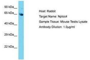 Image no. 1 for anti-Nuclear Protein Localization 4 Homolog (NPLOC4) (AA 96-145) antibody (ABIN6750475) (NPLOC4 anticorps  (AA 96-145))