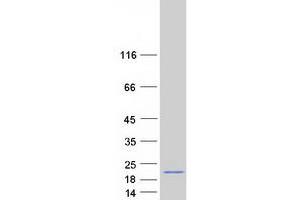 Validation with Western Blot