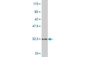 Western Blot detection against Immunogen (34.