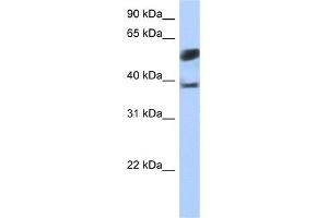 WB Suggested Anti-SPOPL Antibody Titration:  0. (SPOPL anticorps  (N-Term))